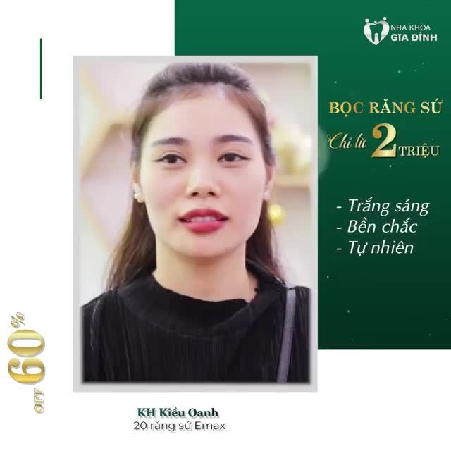 THẨM MỸ RĂNG SỨ E.MAX CAO CẤP – KHOE NỤ CƯỜI RẠNG NGỜI, TỰ TI