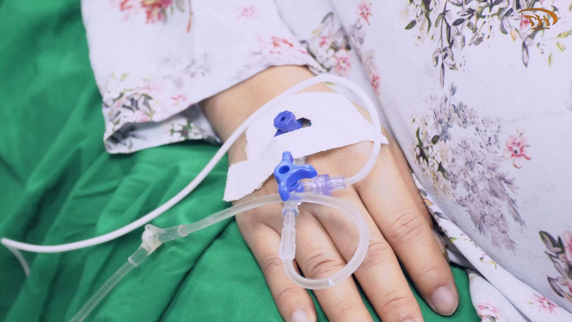 Bao nhiêu năm trời chung sống và tự ti vì "HÀM HÔ", chị Thanh Tâm đã quyết tâm tìm đến bs Hoàng Tuấn để thay đổi.