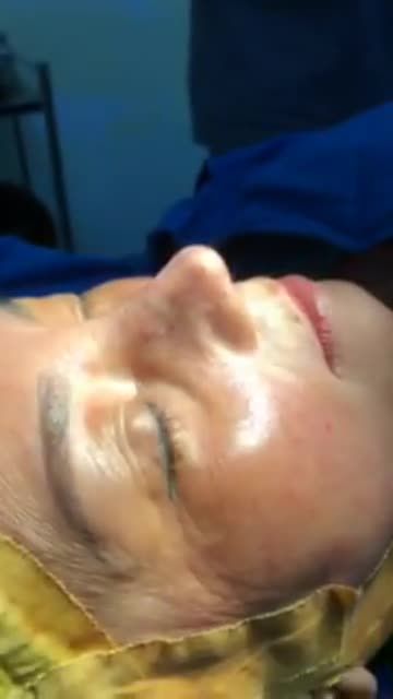 Xử lý mũi hỏng