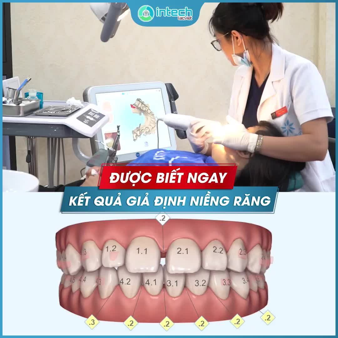NGÀY HỘI NIỀNG RĂNG INVISALIGN NGÀY 22.5.2020
