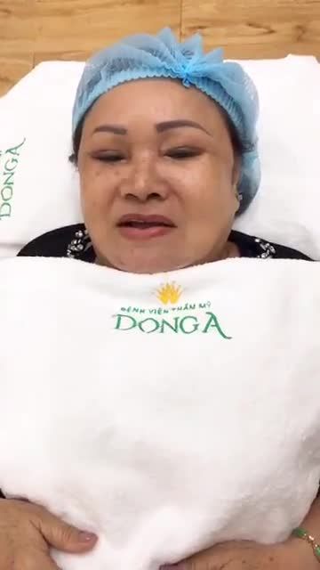 Điều trị SẸO LỒI thực tế nhé cả nhà