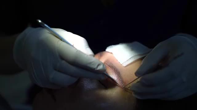 NÂNG CUNG MÀY - GIẢI PHÁP THẨM MỸ GIÚP XÓA NHÒA DẤU HIỆU TUỔI TÁC NƠI ĐÔI MẮT