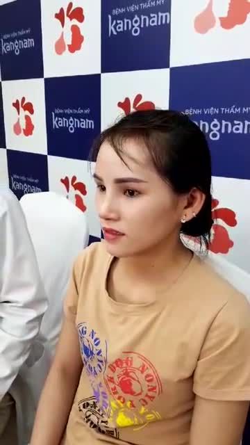 KHÁCH HÀNG NÂNG MŨI SLINE 4D - CẮT CÁNH MŨI