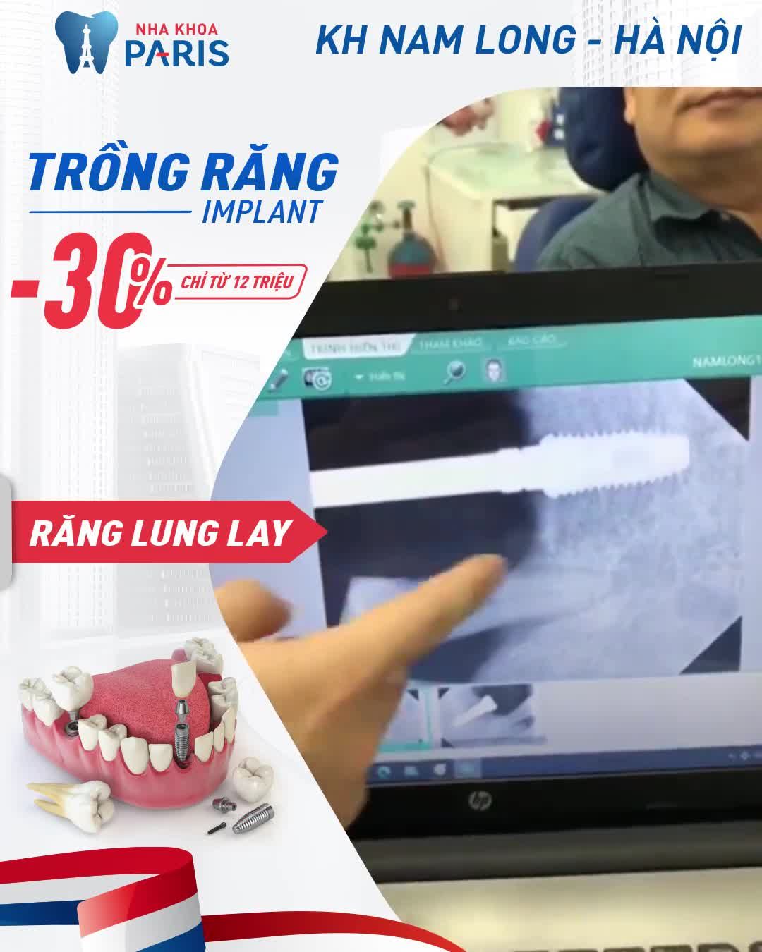 LẮNG NGHE Cảm Nhận Chú Nam Long (Hà Nội) Sau Trồng Răng Implant tại nha khoa Paris 39 Quang Trung