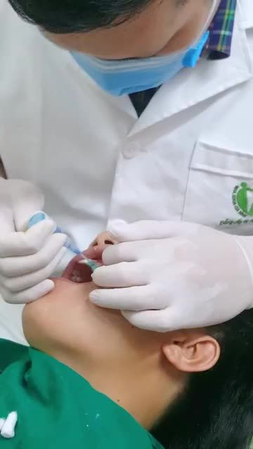 Case khách hàng dán 20 veneer sứ - Anh Nguyễn Văn Thắng tại Nha khoa Gia Đình chi nhánh Tô Hiến Thành.