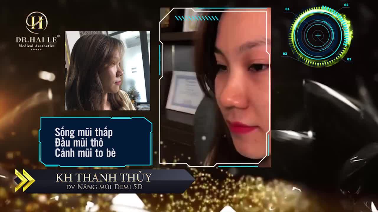 CHIẾC MŨI THẤP TẸT CẢN TRỞ SỰ TỰ TIN CỦA BẠN