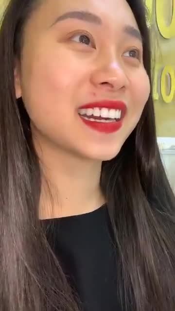 CHUẨN THẦN THÁI HOTGIRL SAU BỌC 24 RĂNG SỨ DIAMOND CÙNG TS.BS TRỊNH ĐỨC MẬU – NHA KHOA QUỐC TẾ VIỆT ĐỨC CƠ SỞ 84A HAI BÀ TRƯNG