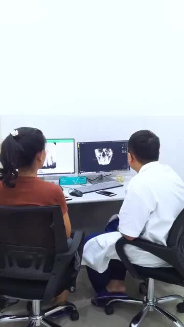 HOÀN TẤT TRỒNG RĂNG IMPLANT THAY THẾ 4 RĂNG CỬA GÃY RỤNG DO LÀM RĂNG SỨ