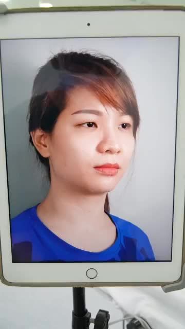 KHÁCH HÀNG VỪA CẮT MÍ TẠI DR.HOẠT