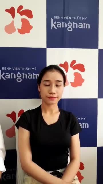 Mũi NGẮN - Cánh mũi TO BÈ, đây là nhan sắc sau 14 NGÀY nâng mũi Cấu trúc 4D