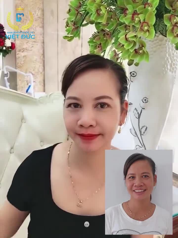 AI NÓI TRÊN 30 TUỔI NIỀNG RĂNG KHÔNG HIỆU QUẢ ?