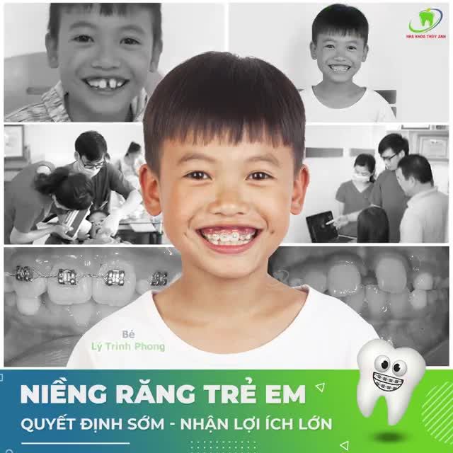 NIỀNG RĂNG CHO CON NGAY HÔM NAY KIẾN TẠO NỤ CƯỜI - ĐỊNH HƯỚNG TƯƠNG LAI