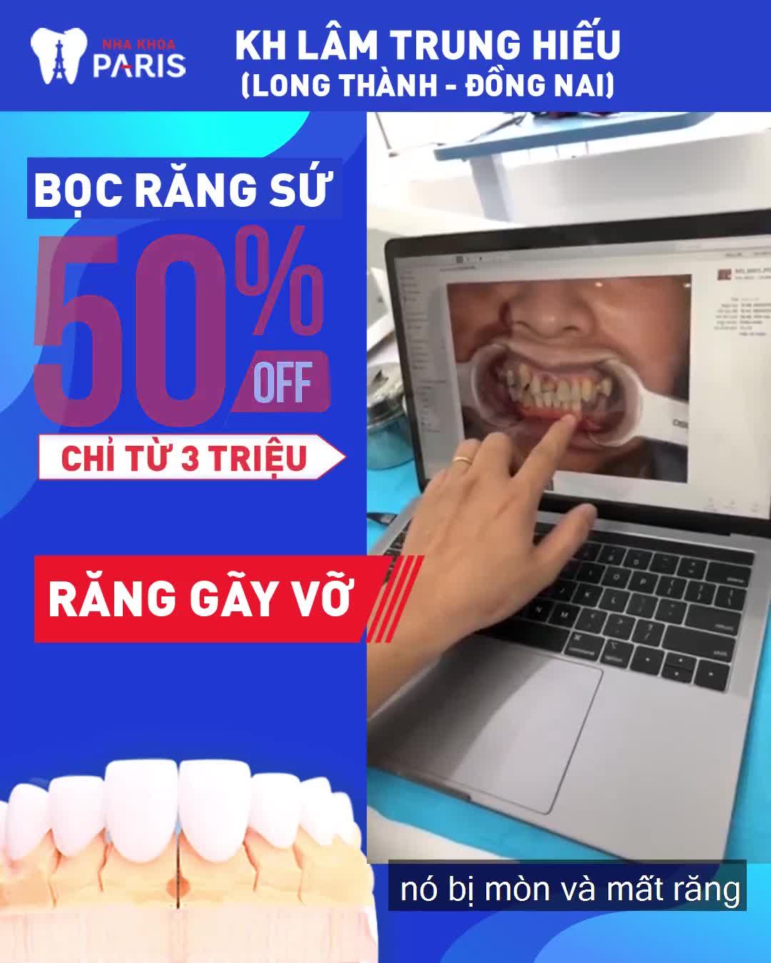 2 NGÀY PHỤC HÌNH SỨ CÙNG CHUYÊN GIA HỒ CHÍ MINH - THAY NỤ CƯỜI MỚI