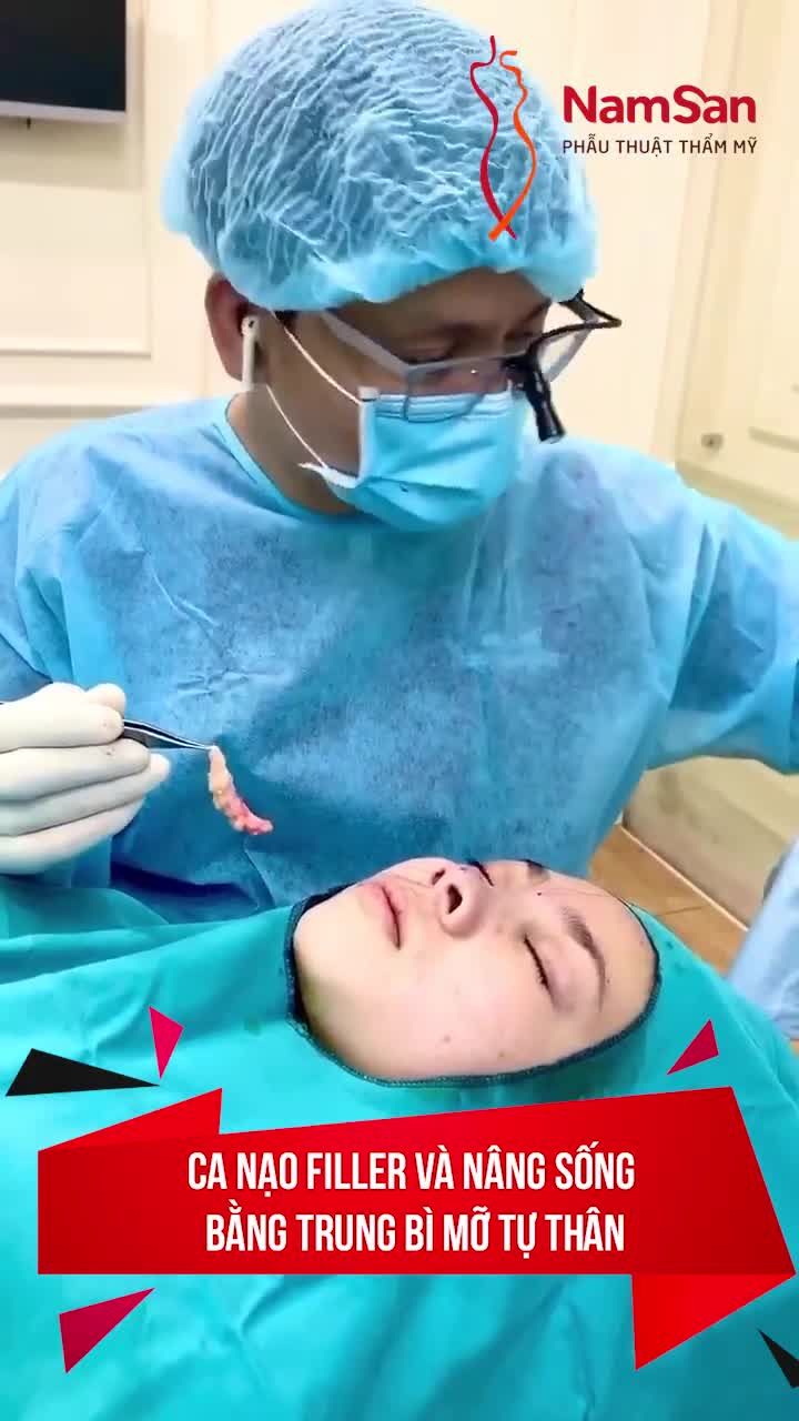ĐIỀU BẠN CẦN BIẾT TRƯỚC KHI TIÊM NÂNG MŨI FILLER