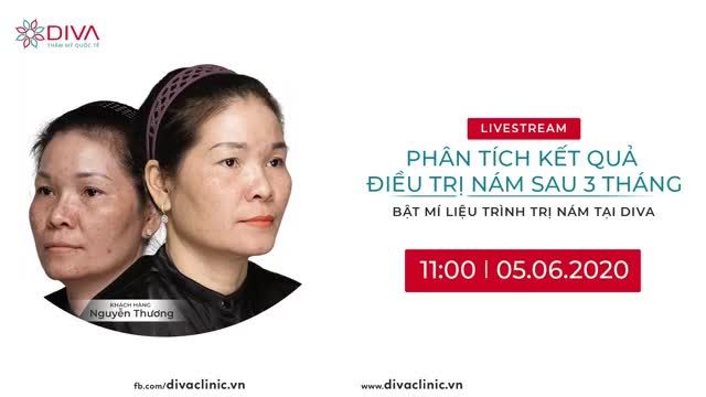 PHÂN TÍCH KẾT QUẢ ĐIỀU TRỊ NÁM SAU 3 THÁNG – BẬT MÍ LIỆU TRÌNH TRỊ NÁM TẠI DIVA