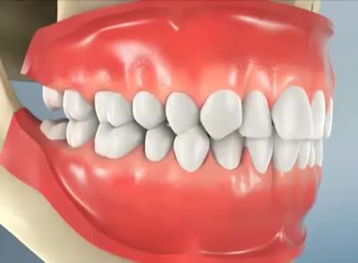 RĂNG KHÔN ĐI, NỤ CƯỜI Ở LẠI GIÁ KHUYẾN MẠI, NGẠI GÌ NHỔ ĐI