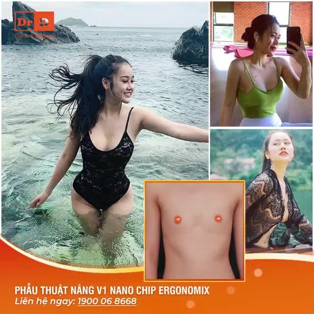 Sinh ra là con gái nhưng mang bộ ngực của một thằng con trai.