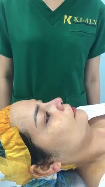 CƠ HỘI DUY NHẤT ĐỂ BẠN NHÌN RÕ QUÁ TRÌNH NÂNG TẠO DÁNG MŨI NGAY TẠI PHÒNG PHẪU THUẬT