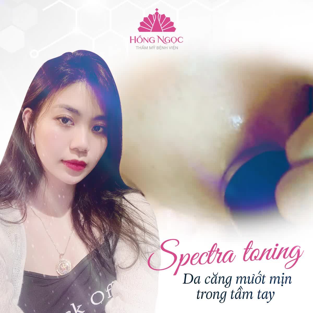 SPECTRA TONING - DA CĂNG MƯỚT MỊN TRONG TẦM TAY