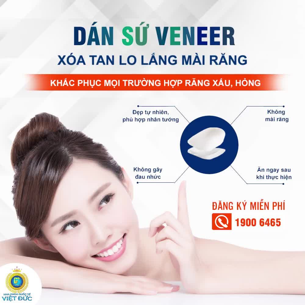 DÁN SỨ VENEER XÓA TAN LO LẮNG MÀI RĂNG – TỰ TIN CƯỜI TỎA NẮNG