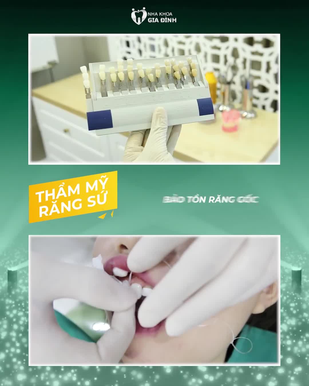 THẨM MỸ RĂNG CHỈ TỪ 2TR/RĂNG – ĐẸP SAU 2 NGÀY!