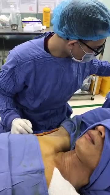 Công đoạn cuối cùng của Hút bỏ tuyến mồ hôi nách Endo Dry cùng Kangnam