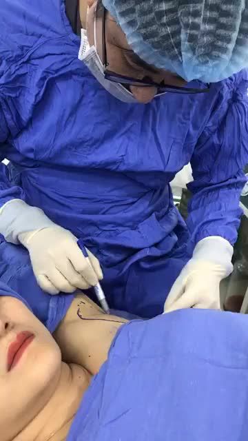 Công nghệ chiếu sáng Laser hút tuyến mồ hôi nách Endo Dry- không đau không tím đỏ cùng Kangnam