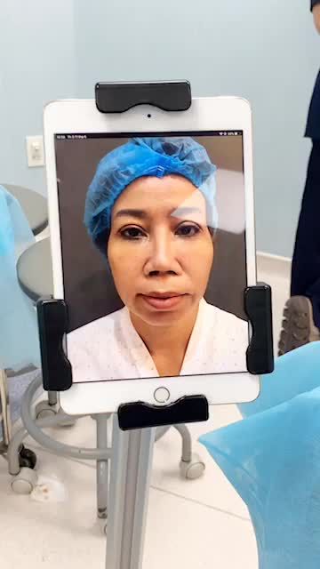 HẾT HỒN VỚI DÁNG MŨI SAU NÂNG TẠI PHÒNG PHẪU THUẬT