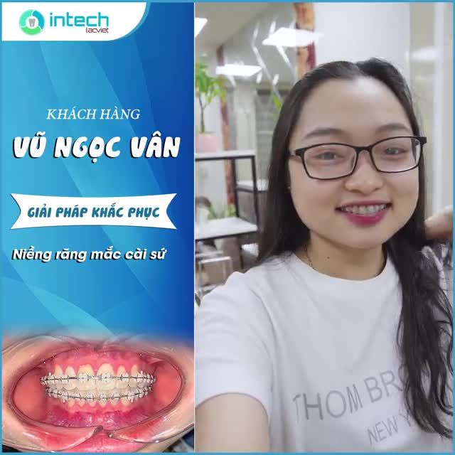 TẠM BIỆT HÀM RĂNG KHẾP KHỂNH CHỈ SAU 10 THÁNG