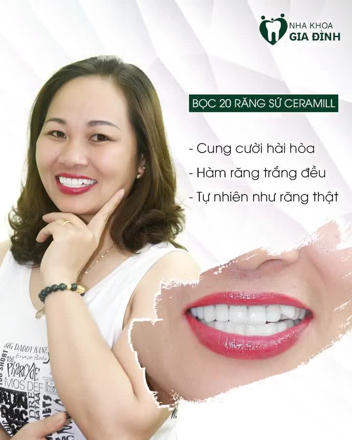 VUI SƯỚNG VÀ CẢM THẤY RẤT HÀI LÒNG SAU KHI SỞ HỮU NỤ CƯỜI MỚI