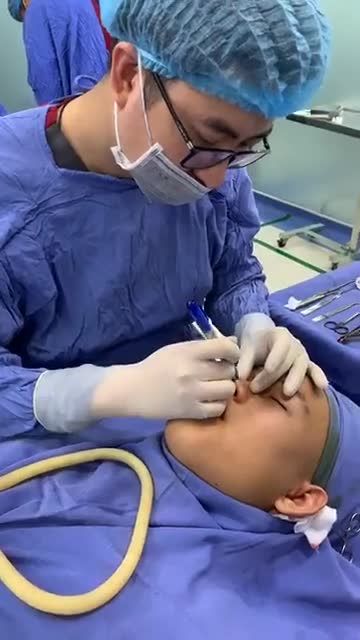 Bs Kangnam phân tích nâng mũi Cấu trúc 4D Nanofrom
