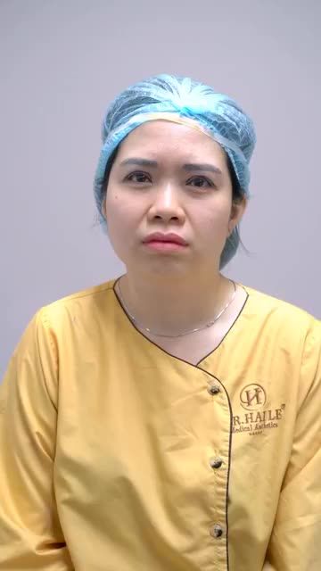 Trẻ hóa đôi mắt cho chị gái bằng phương pháp cắt mí độc quyền.
