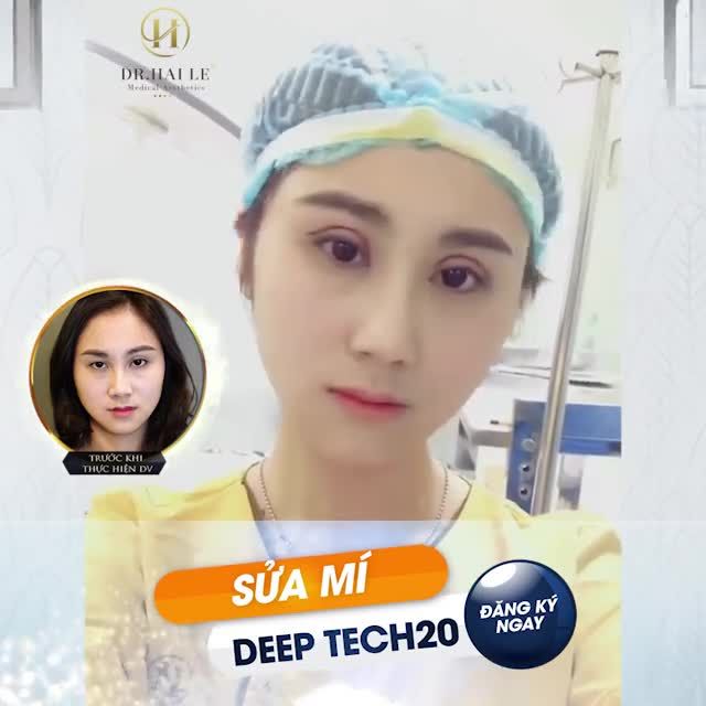 SỬA MÍ DEEP TECH 20 GÂY BẤT NGỜ VỚI KẾT QUẢ TRƯỚC SAU !