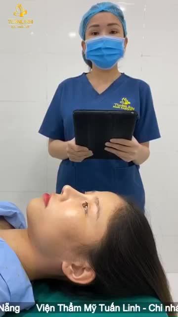 Case Nâng mũi bán cấu trúc bọc Megaderm.