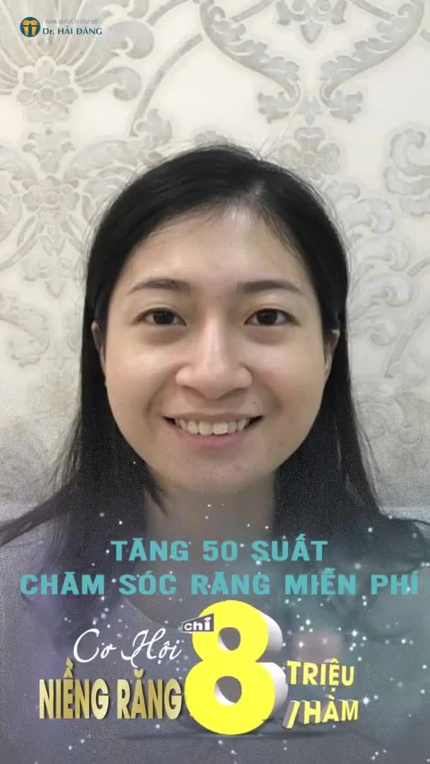 NÂNG CẤP NỤ CƯỜI NHÂN 10 TÀI LỘC