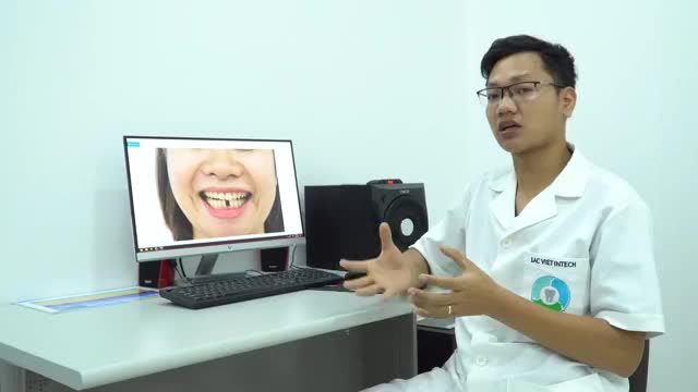 CÙNG BÁC SĨ MAI MINH VƯƠNG PHÂN TÍCH BỆNH NHÂN MẤT RĂNG CỬA.