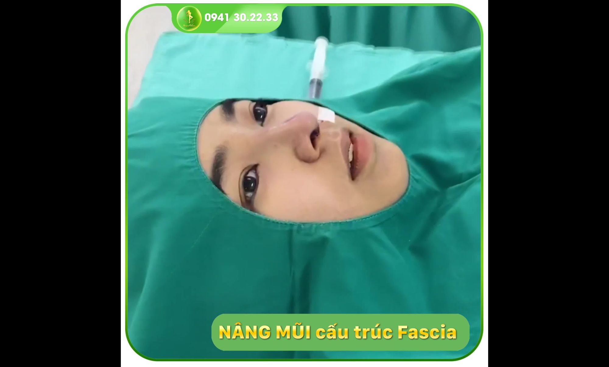DÁNG MŨI CẤU TRÚC FASCIA CAO TÂY CHO CÔ NÀNG CÁ TÍNH