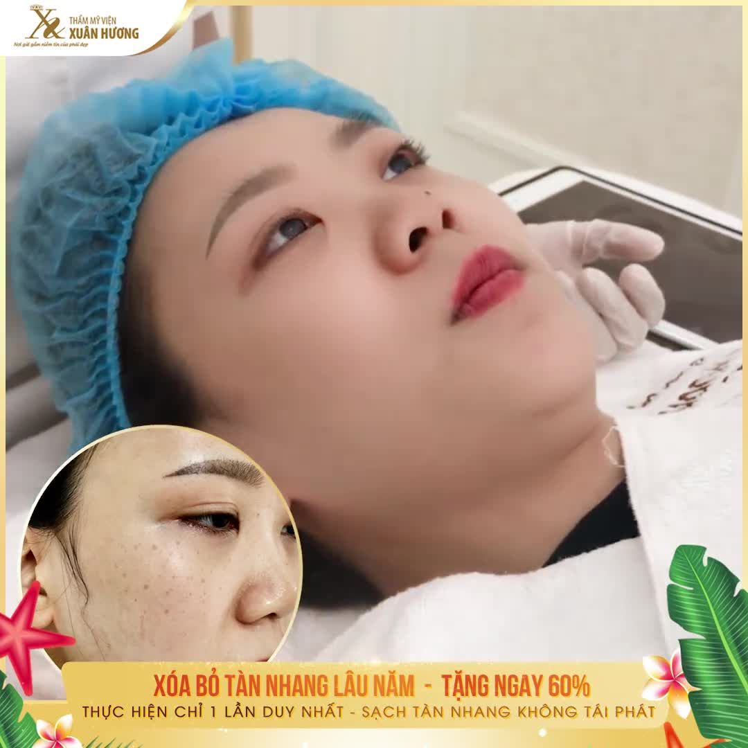 TÀN NHANG LÂU NĂM CỨNG ĐẦU, DÙNG ĐỦ MỌI CÁCH KHÔNG HIỆU QUẢ