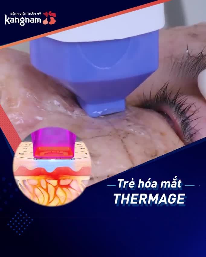 Trẻ hóa da Thermage ‼️TẶNG TỚI 46 TRIỆU