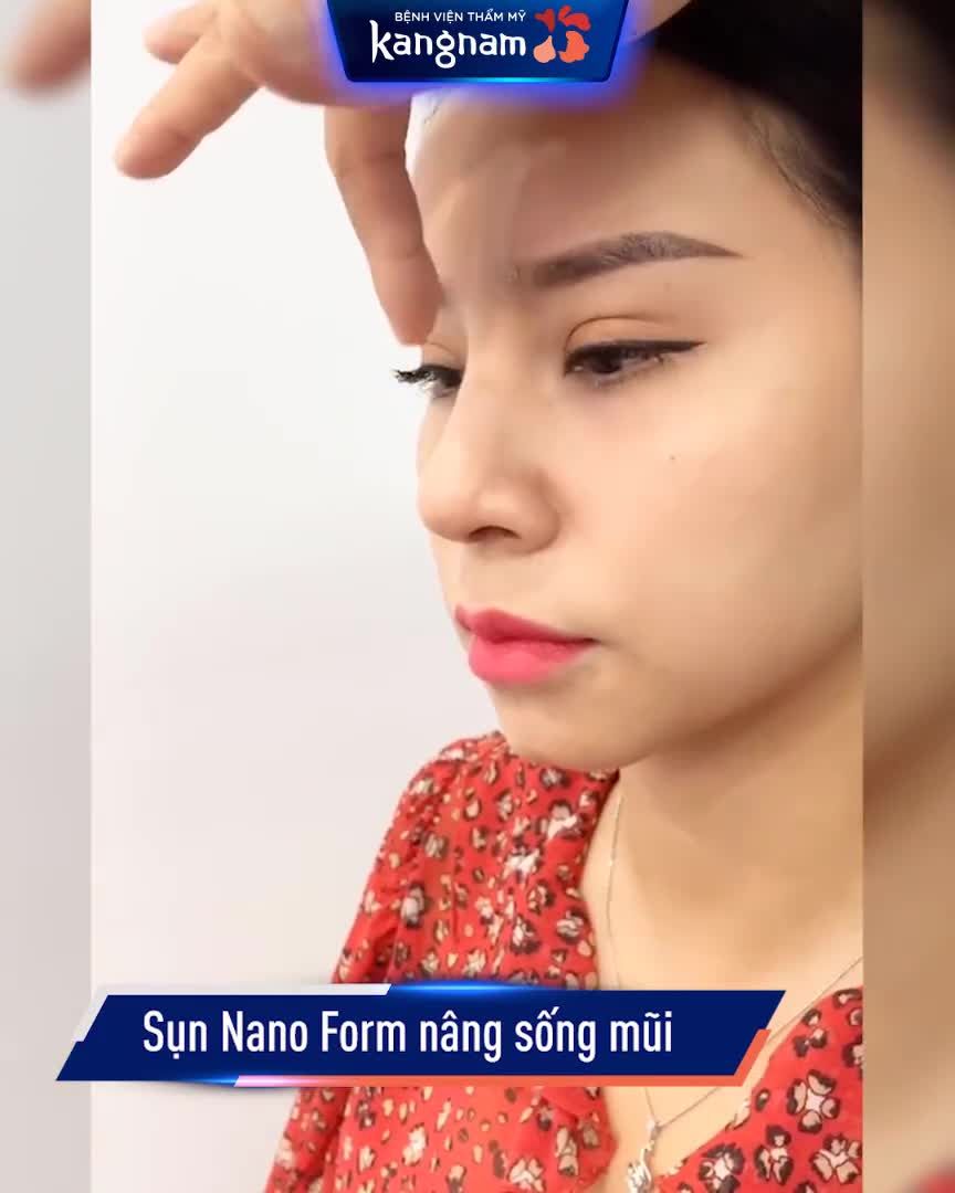 Mũi 10 ngày - sang chảnh hết nấc!