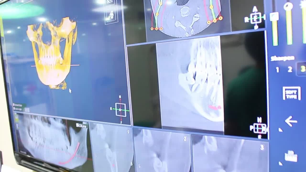 ""TƯỞNG MỆT LẮM MÀ ĐÂU NGỜ CẮM XONG KHỎE RE""