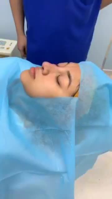 "XUẤT XƯỞNG" THÀNH CÔNG SIÊU PHẨM NÂNG MŨI CẤU TRÚC