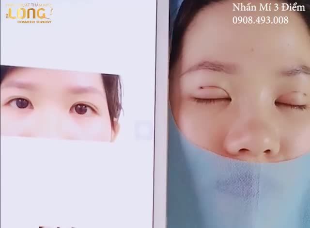 Bao nhiêu lâu để có được 1 đôi mắt đẹp Chỉ với 30 phút