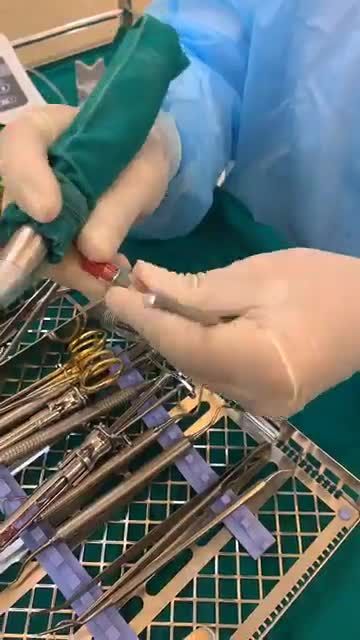 Ca cấy ghép Implant R46 và ca thẩm mỹ 21 răng sứ tại Nha khoa Dr. Hải Đăng