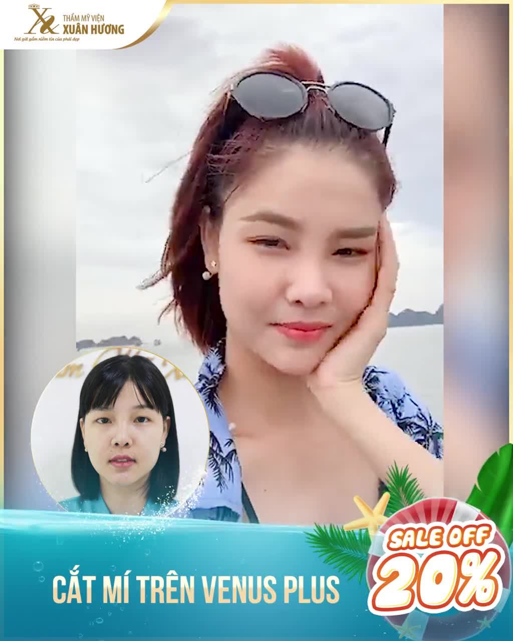 MẮT 2 MÍ SẮC NÉT - "ĂN HÌNH" CỰC ĐỈNH NHƯ SIÊU MẪU KỲ HÂN