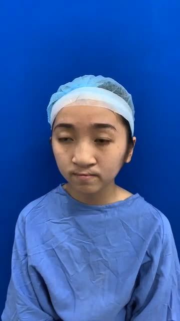 Đội ngũ bác sĩ Kangnam phân tích, lên kế hoạch "giải cứu" ca mũi phức tạp