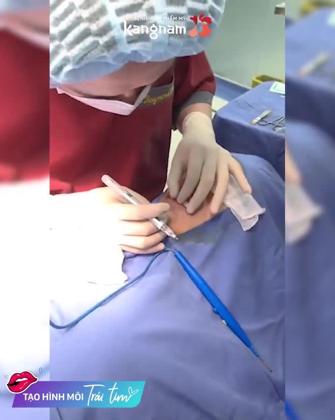 TẠO HÌNH VÀ THU MỎNG MÔI như thế nào để có tỉ lệ ĐẸP?