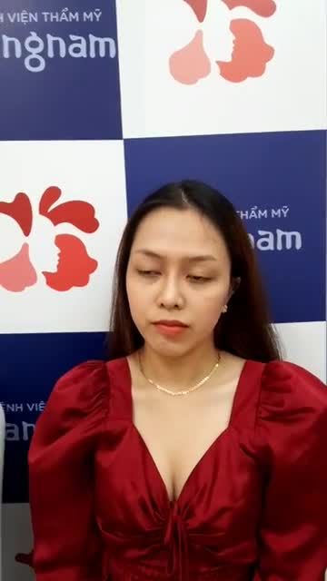"Lột xác" hoàn toàn sau 5 tháng Nâng mũi cấu trúc 4D