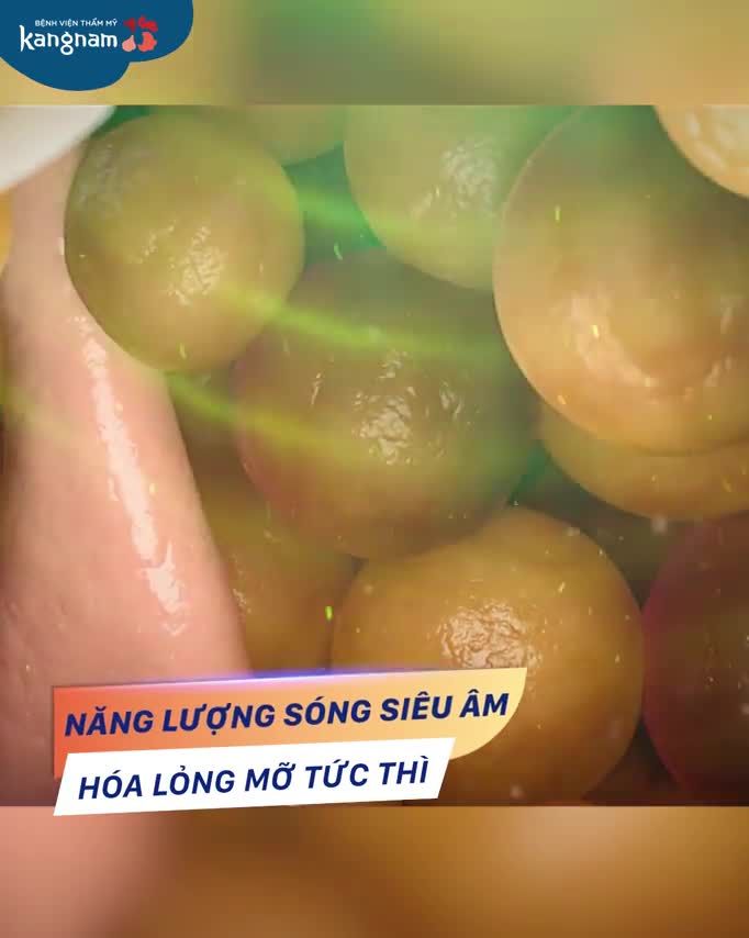 Giảm mỡ với công nghệ TỐT NHẤT
