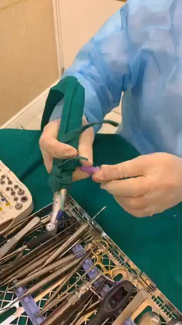 CA NHỔ CHÂN RĂNG VÀ CẤY GHÉP IMPLANT TỨC THÌ CỦA PHÁP